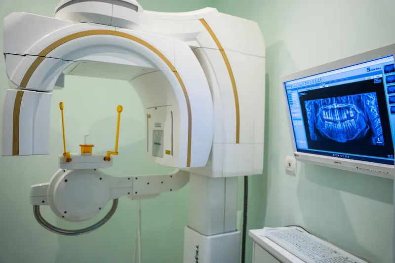 Equipo de radiología 3D de DentaCare Mallorca